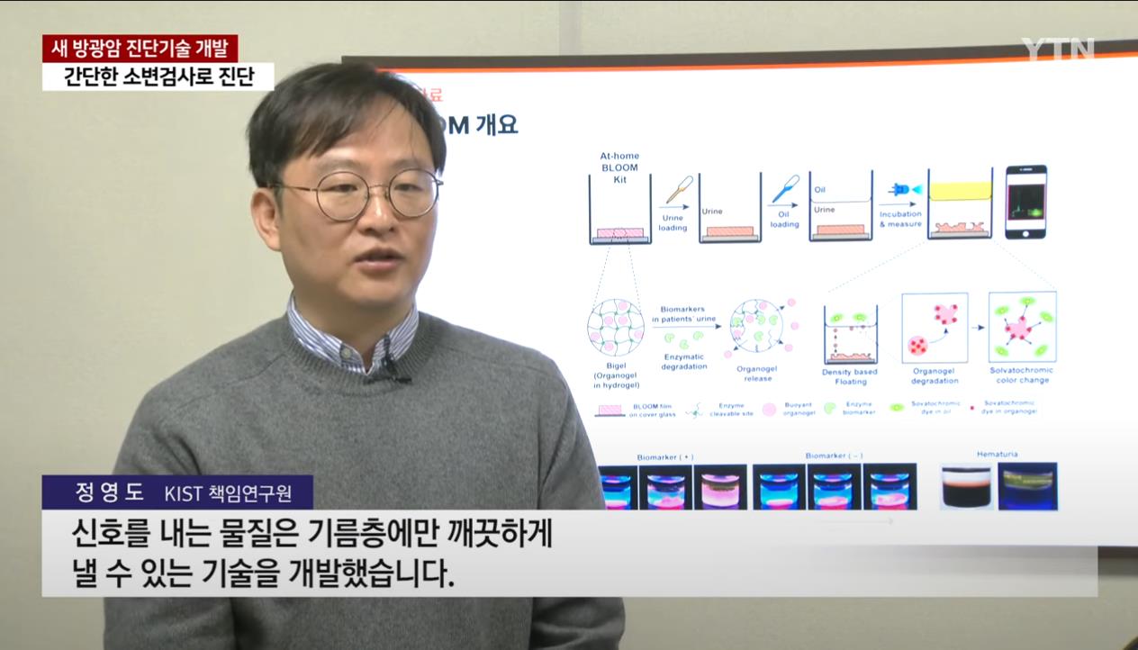 이슈/유머 - 집에서 간편하게 소변으로 방광암 진단 가능한 기술 개발