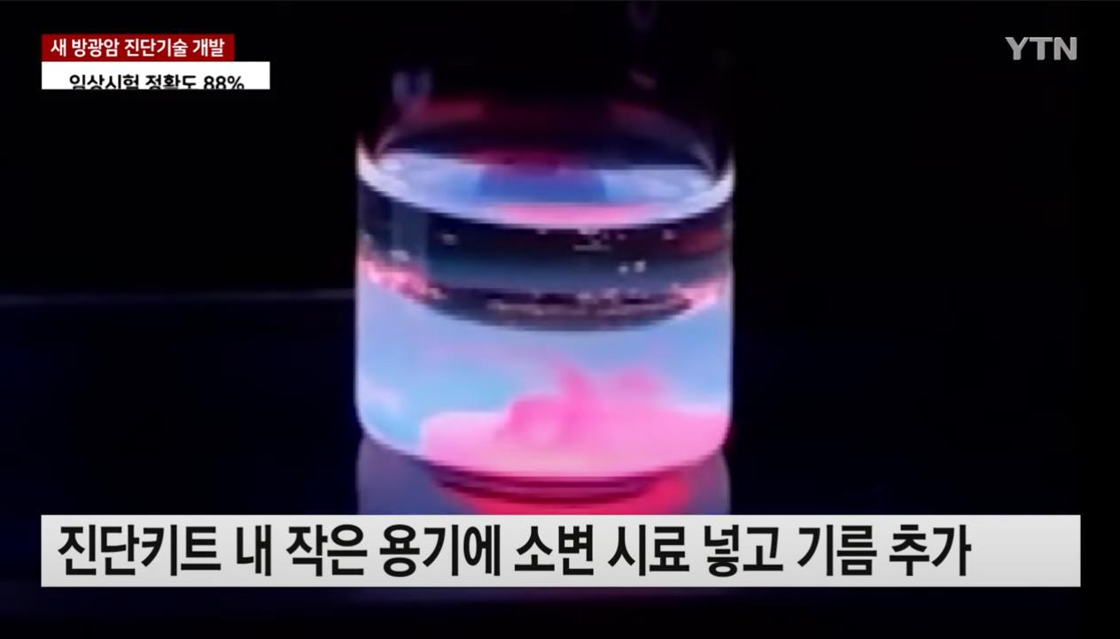 이슈/유머 - 집에서 간편하게 소변으로 방광암 진단 가능한 기술 개발